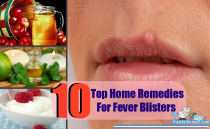 Home Remedies For Fever Blisters