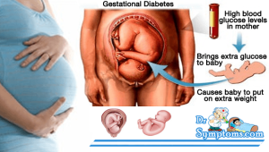 Gestational Diabetes