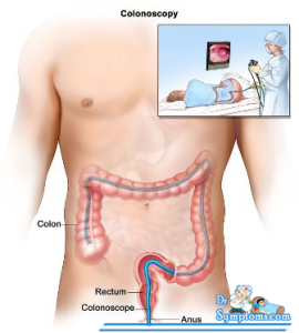 Treatments of Constipation